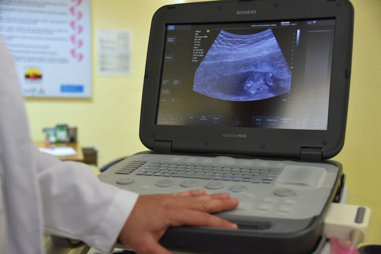 A doctor is looking on a screen at a pregnancy scan